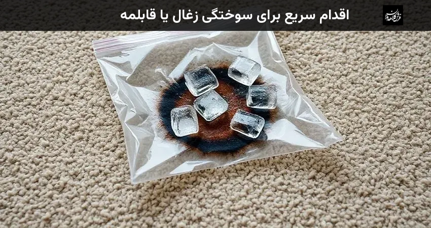 اقدام سریع برای سوختگی زغال یا قابلمه